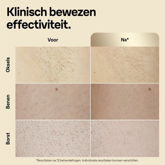 Braun IPL Ontharingsapparaat Silk-expert Pro 5 - ontharing voor thuis - Etui - Venus-scheersysteem -