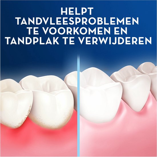 Lichaamsdeel, Mond, Persoon, Tanden