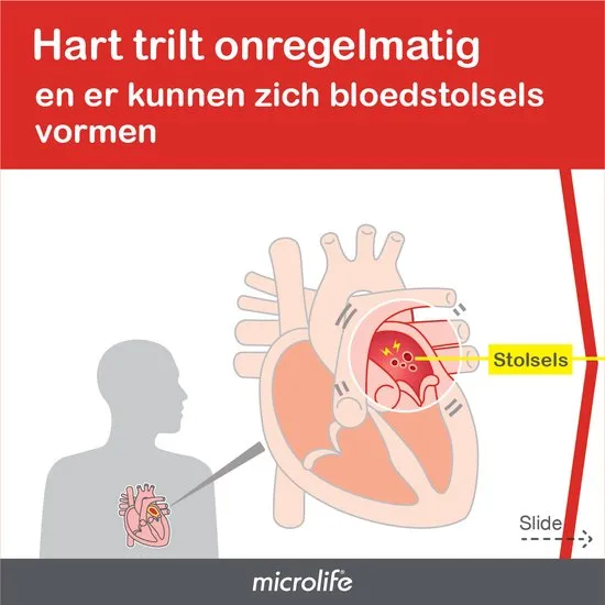 Microlife BP B3 AFIB - Bovenarm Bloeddrukmeter - Klinisch Gevalideerd - No. 1 merk bij huisartsen