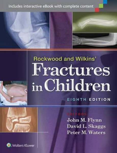 Rockwood and Wilkins' Fractures in Children ( Boek Engels)