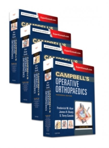 Campbell's Operative Orthopaedics, Volume 3
